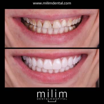 Slider image (6) Milim Dental